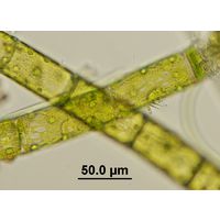 Oedogonium
