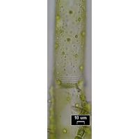 Oedogonium