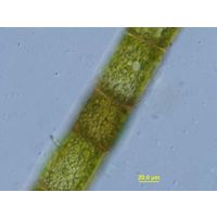 Oedogonium