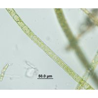 Oedogonium undulatum