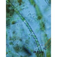 Oedogonium undulatum