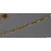 Oedogonium undulatum