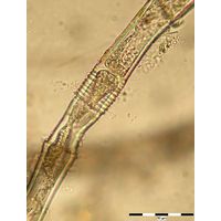 Oedogonium sp.