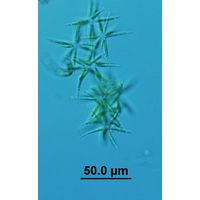 Actinastrum hantzschii