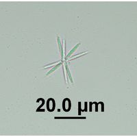 Actinastrum hantzschii