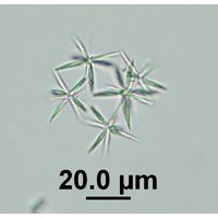 Actinastrum hantzschii