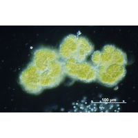 Botryococcus braunii