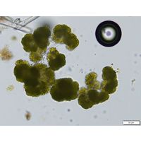 Botryococcus braunii