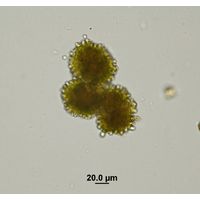 Botryococcus braunii