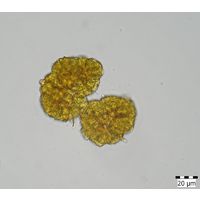 Botryococcus braunii