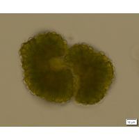 Botryococcus braunii