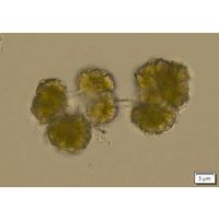 Botryococcus terribilis
