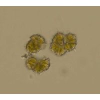 Botryococcus terribilis
