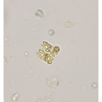Crucigeniella apiculata