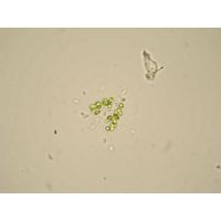 Dictyosphaerium ehrenbergianum