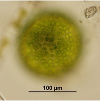 Eremosphaera viridis