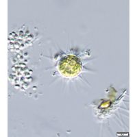 Glochiococcus aciculiferus