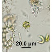 Lagerheimia ciliata