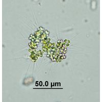 Micractinium borhnhemiense