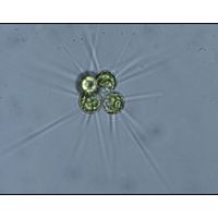 Micractinium bornhemiense