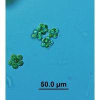 Micractinium crassisetum