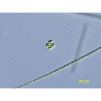 Micractinium pusillum