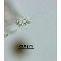 Micractinium pusillum