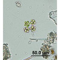 Micractinium pusilum