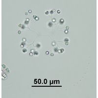 Mucidosphaerium cf. pulchellum