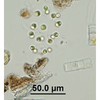 Mucidosphaerium pulchellum