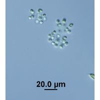 Mucidosphaerium pulchellum