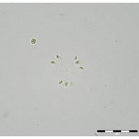 Mucidosphaerium sphagnale