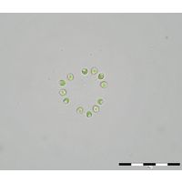 Mucidosphaerium sphagnale