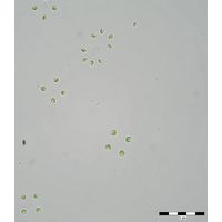 Mucidosphaerium sphagnale