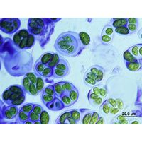 Nephrocytium agardhianum