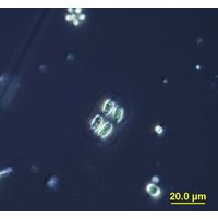 Oocystis lacustris