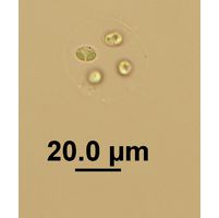 Oocystis lacustris 