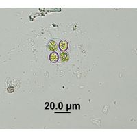 Oocystis marssonii