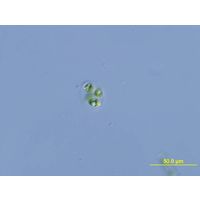 Oocystis marssonii