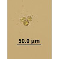 Oocystis cf. marssonii