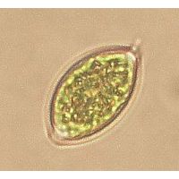 Oocystis solitaria