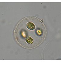Quadricoccus verrucosus