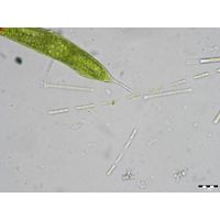 Binuclearia lauterbornii