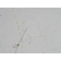 Binuclearia lauterbornii