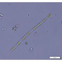 Binuclearia lauterbornii