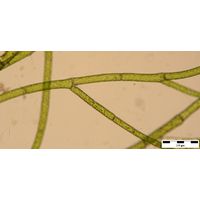 Cladophora globulina 