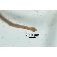 Trentepohlia aurea
