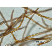 Trentepohlia aurea