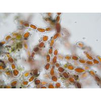 Trentepohlia