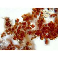 Trentepohlia umbrina